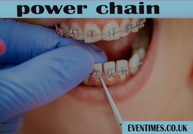 Power Chain Braces: Your Complete Guide to Faster Orthodontic Results